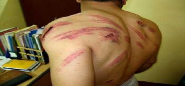 Egyptian Citizen Dies of Torture in Police Station