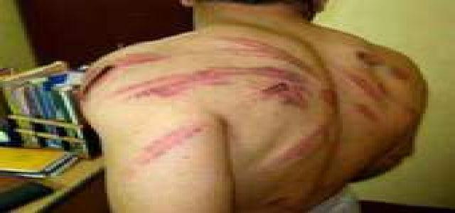 The Interior Minister Faces Inquiry on Torture