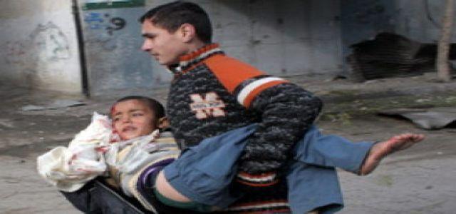 Two children injured in attacks by Israeli settlers in Al-Khalil